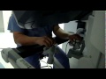 Robotic-assisted Pyeloplasty procedure