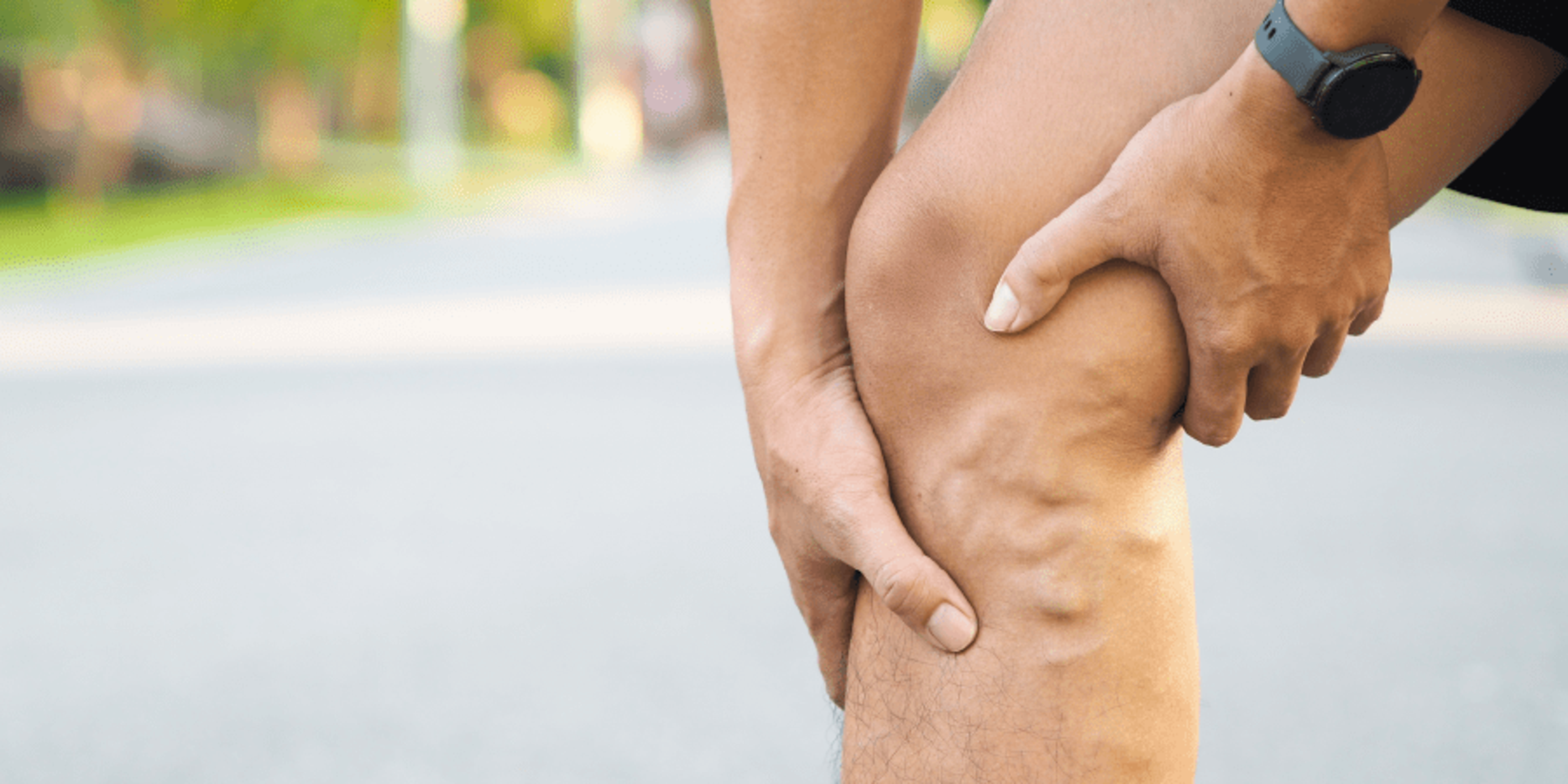 man holding leg with varicose veins