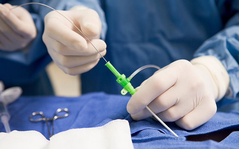 cardiac-heart-surgery-catheter