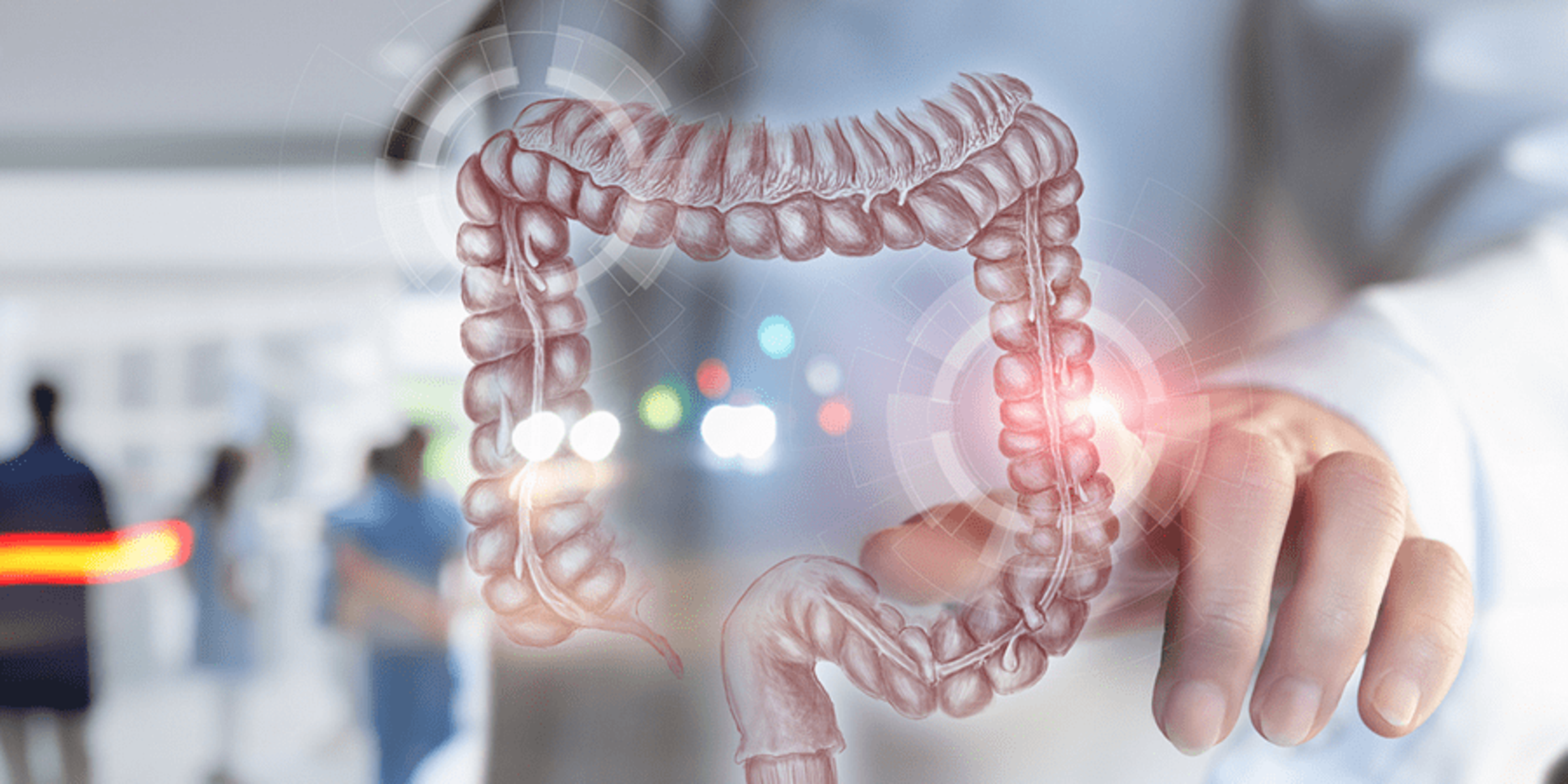 surgery colorectal cancer care