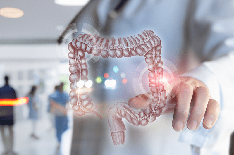 surgery colorectal cancer care