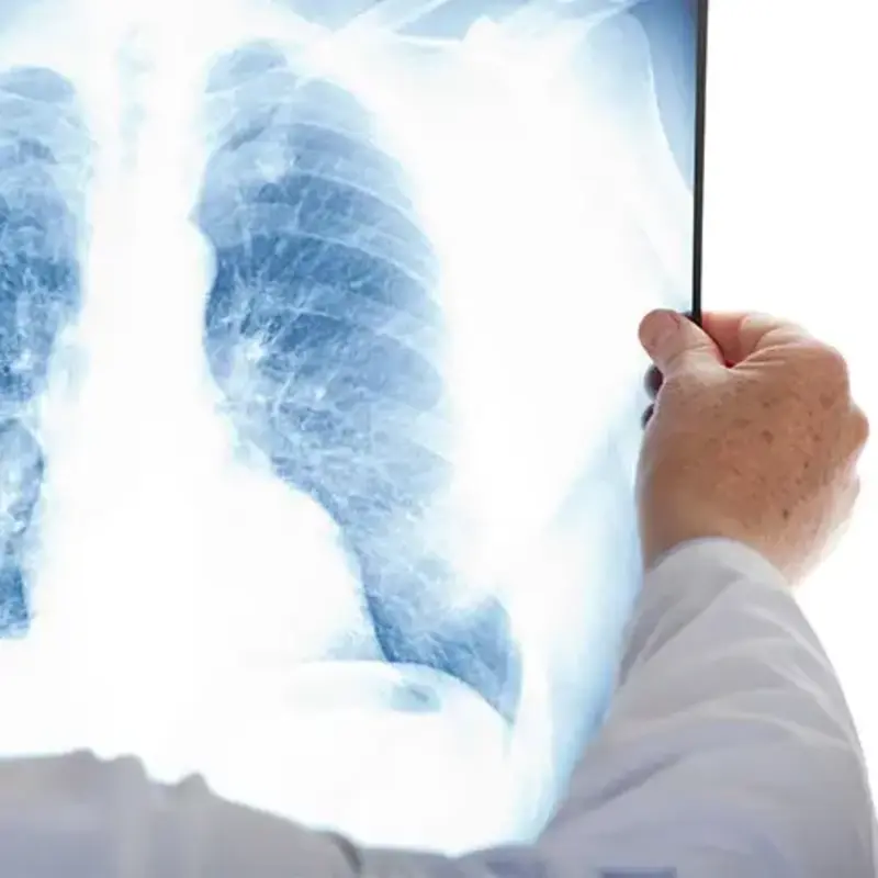doctor looks at xray