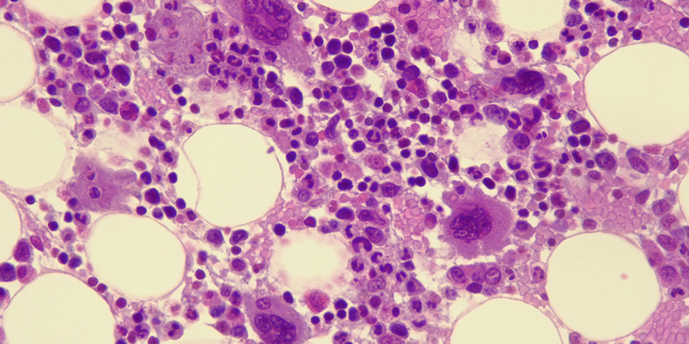 bone marrow