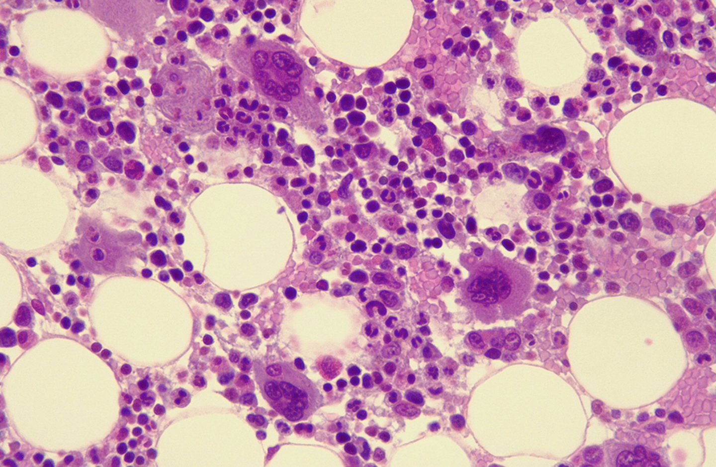 bone marrow