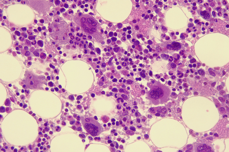 bone marrow