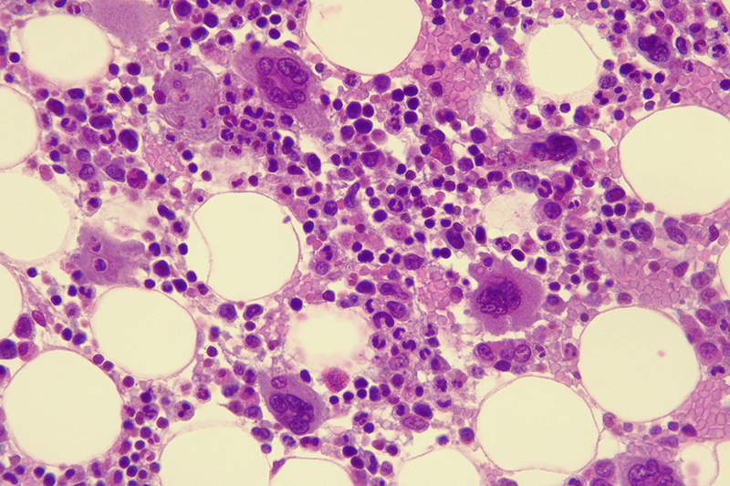 bone marrow