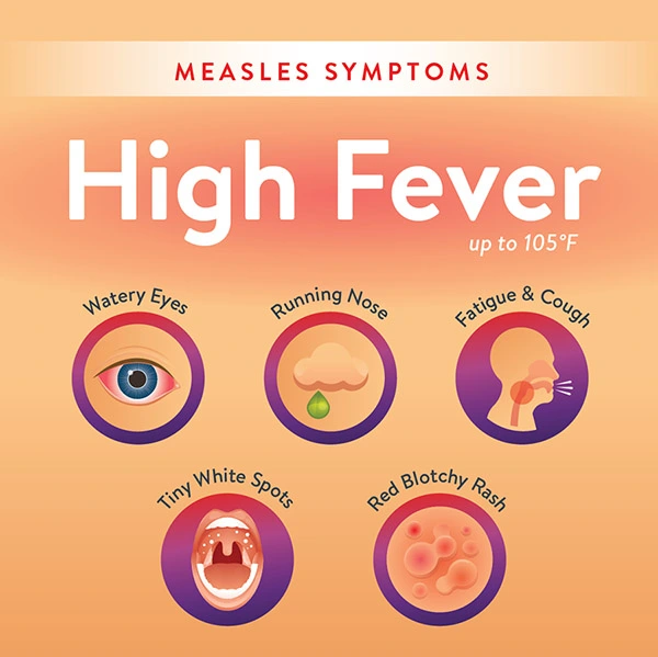 measles symptoms copy