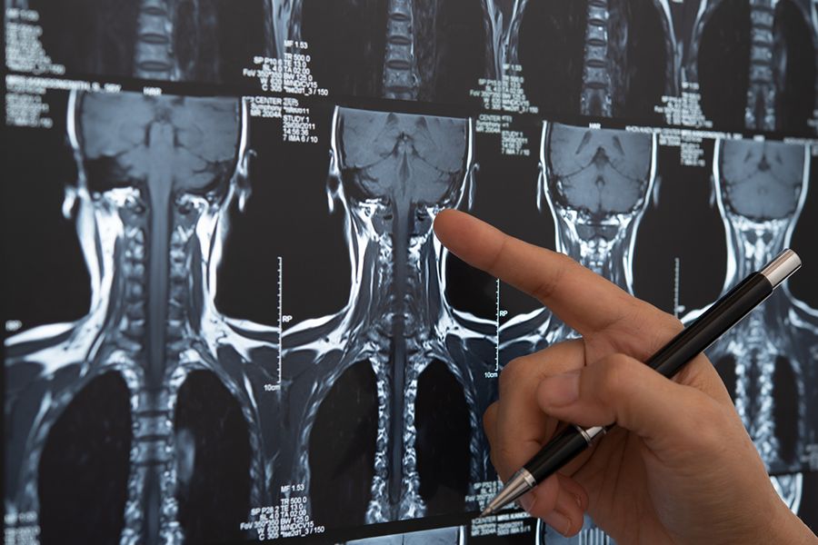 Roper-Neurosurgery-expanding-doctor-pointing-at-xray