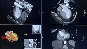 ct scan usinf APEX CT scanner;