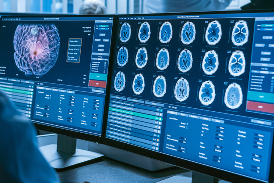 brain tumor - article
