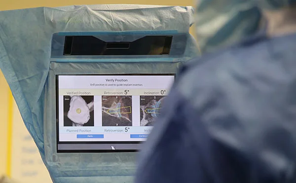 another view of computer screen while in surgery