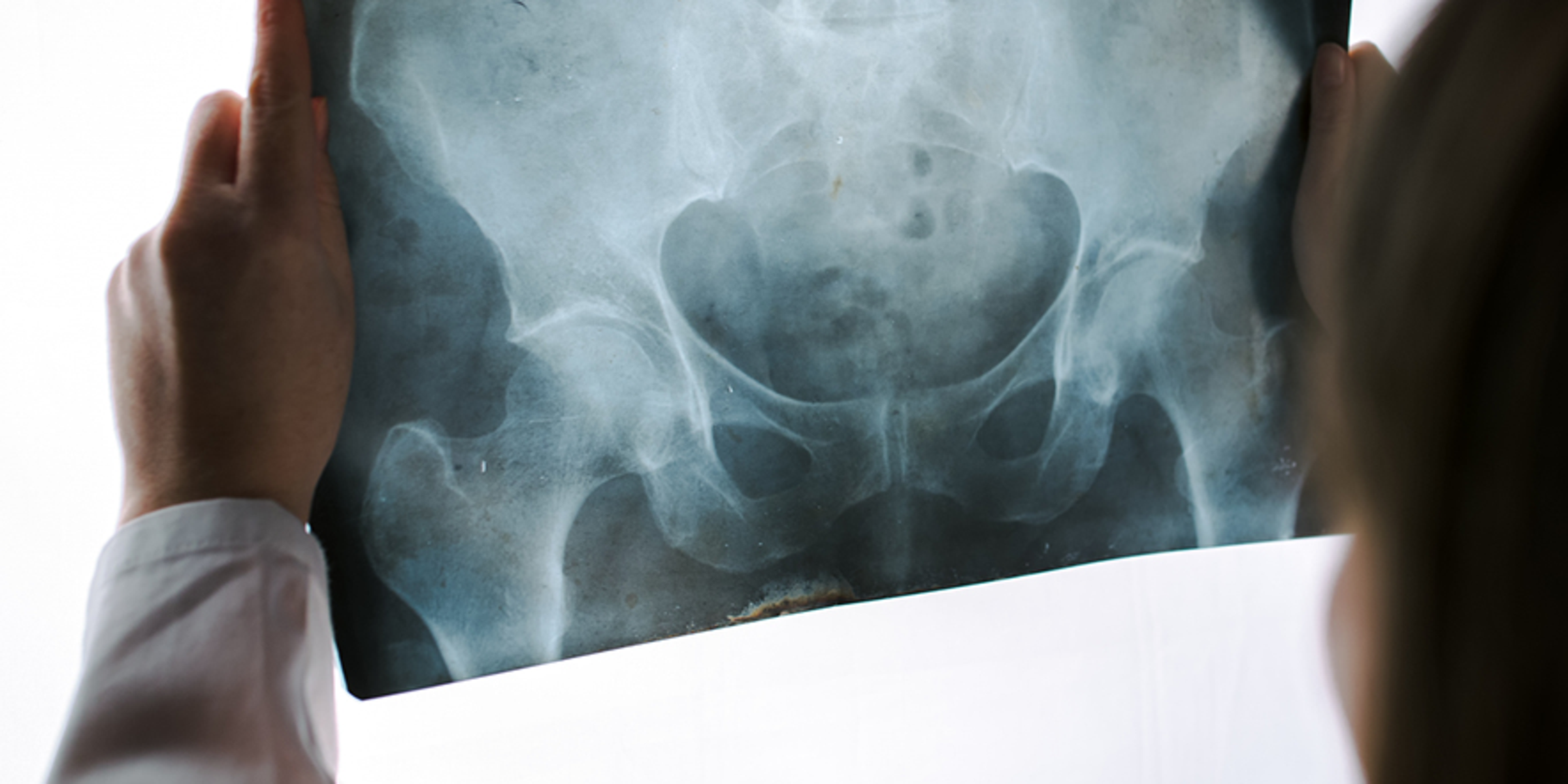 pelvis xray