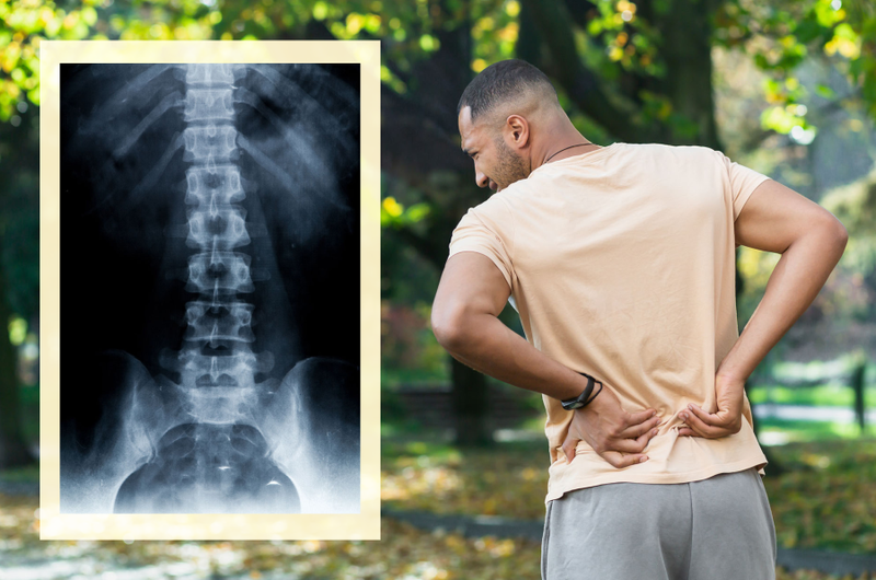 man with back pain