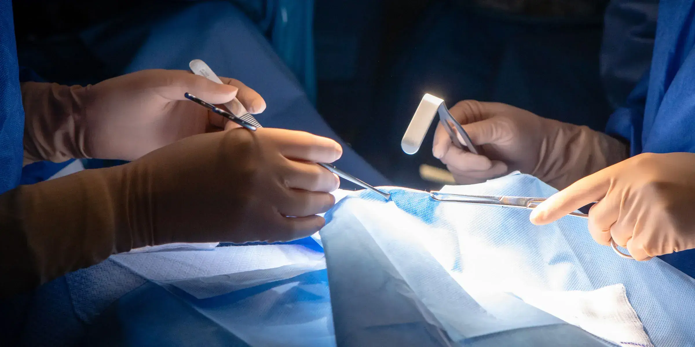 Surgeons hands