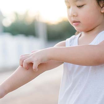 child scratching their arm